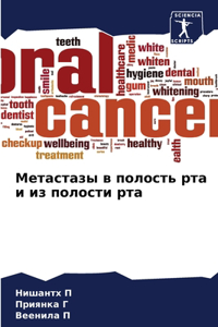 Метастазы в полость рта и из полости рта
