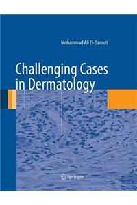 Challenging Cases in Dermatology