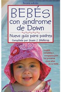 Bebes con sindrome de Down