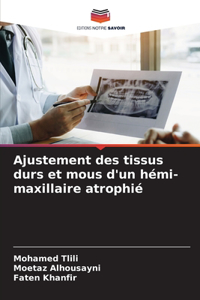 Ajustement des tissus durs et mous d'un hémi-maxillaire atrophié