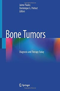 Bone Tumors