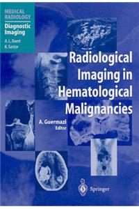 Radiological Imaging in Hematological Malignancies