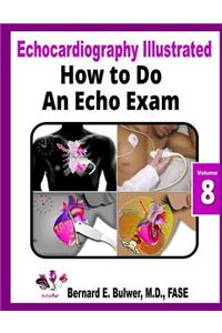 How to Do an Echo Exam