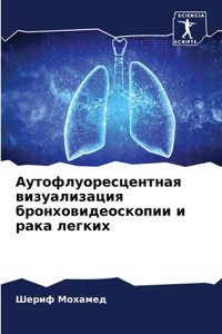 Аутофлуоресцентная визуализация бронхо&#