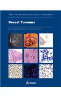 Breast Tumours