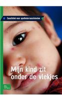 Mijn Kind Zit Onder de Vlekjes