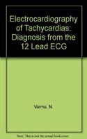 Electrocardiography of Tachycardias