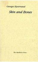 Skin and Bones