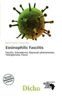 Eosinophilic Fasciitis