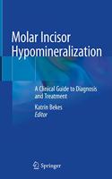 Molar Incisor Hypomineralization: A Clinical Guide to Diagnosis and Treatment