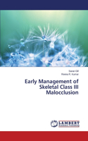 Early Management of Skeletal Class III Malocclusion