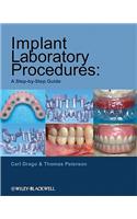 Implant Laboratory Procedures: A Step-By-Step Guide