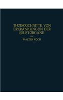 Thoraxschnitte von Erkrankungen der Brustorgane