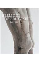 Berlinde de Bruyckere: Suture