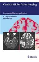 Cerebral MR Perfusion Imaging