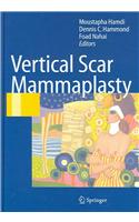 Vertical Scar Mammaplasty