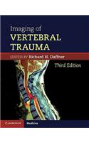 Imaging of Vertebral Trauma