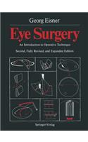 Eye Surgery