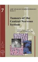 Tumors of the Central Nervous System