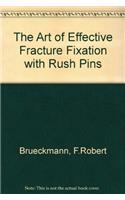 The Art of Effective Fracture Fixation with Rush Pins