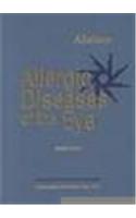 Allergic Diseases of the Eye