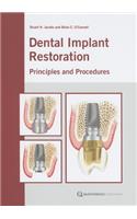 Dental Implant Restoration: Principles and Procedures