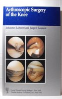 Arthroscopic Surgery of the Knee