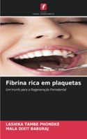 Fibrina rica em plaquetas