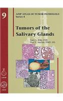 Tumors of the Salivary Glands