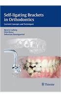 Self-ligating Brackets in Orthodontics: Current Concepts and Techniques