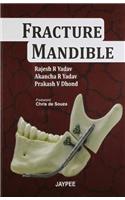 Fracture Mandible