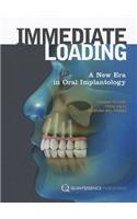 Immediate Loading: A New Era in Oral Implantology: A New Era in Oral Implantology