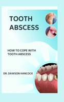 Tooth Abscess