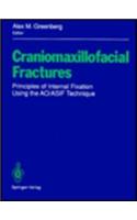 Craniomaxillofacial Fractures