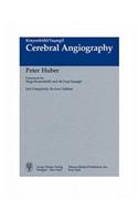 Cerebral Angiography