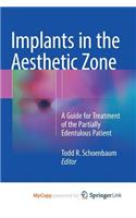 Implants in the Aesthetic Zone