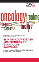 Marcador Ki67 En Los Tumores de Glándulas Salivales.