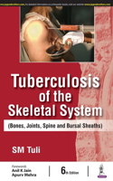 Tuberculosis Of The Skeletal System