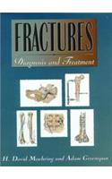 Fractures