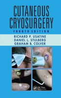 Cutaneous Cryosurgery