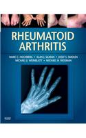 Rheumatoid Arthritis E-Book