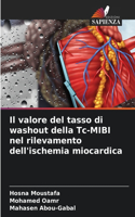 valore del tasso di washout della Tc-MIBI nel rilevamento dell'ischemia miocardica