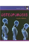 Osteoporosis