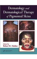 Dermatology and Dermatological Therapy of Pigmented Skins