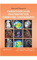 Atlas and Manual of Cardiovascular Multidetector Computed Tomography [With CDROM]