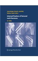 Internal Fixation of Femoral Neck Fractures