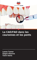 CAO/FAO dans les couronnes et les ponts