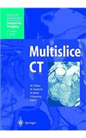 Multislice CT