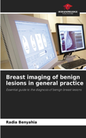 Breast imaging of benign lesions in general practice