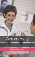 Acromegaly